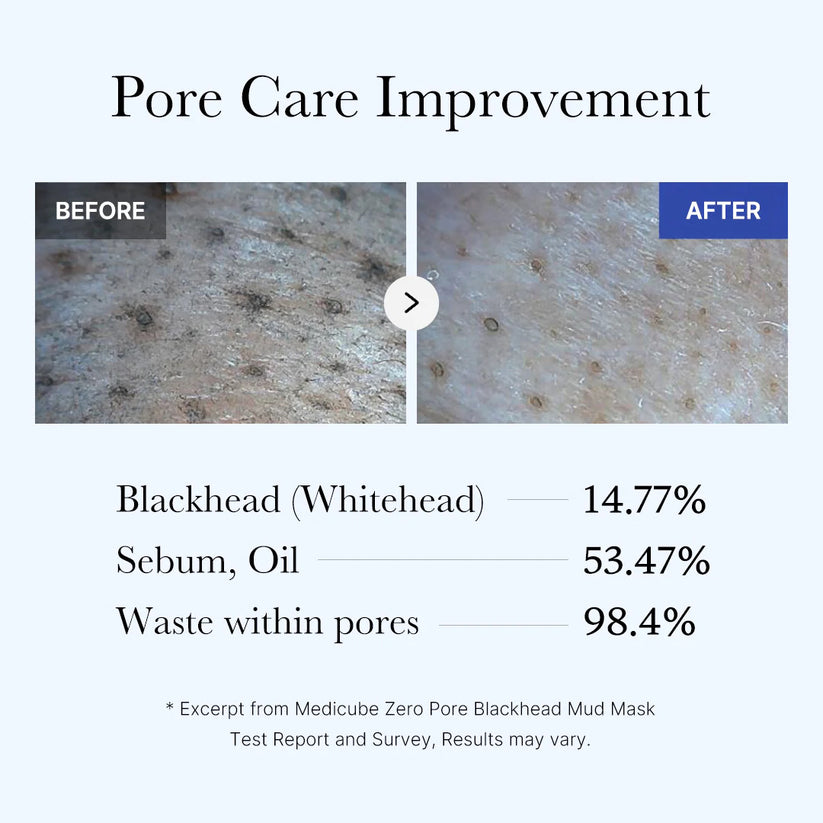 Zero Pore Blackhead Mud Mask & Zero Pore Blackhead Deep Cleansing Oil