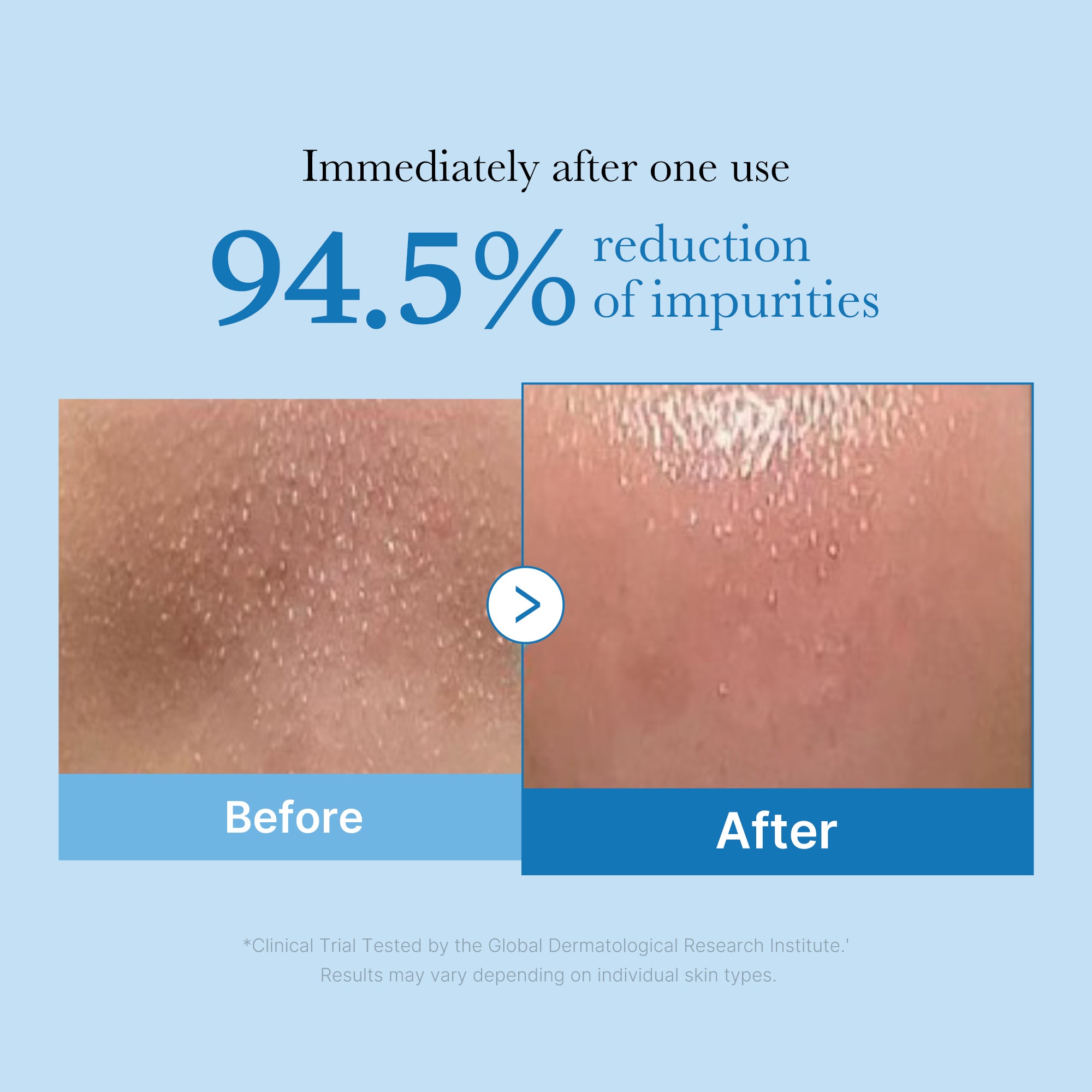 Zero Pore Blackhead Mud Mask & Zero Pore Blackhead Deep Cleansing Oil
